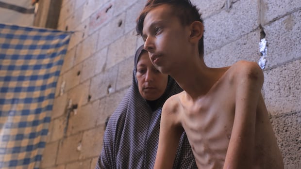 As hunger grows in Gaza, warnings that starvation hits the most vulnerable first