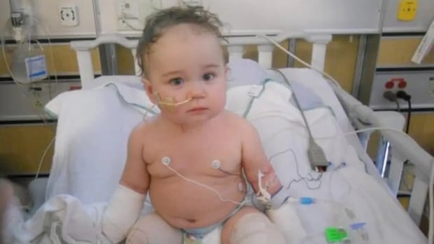 Alberta girl awarded damages in lawsuit over infection leading to quadruple amputation