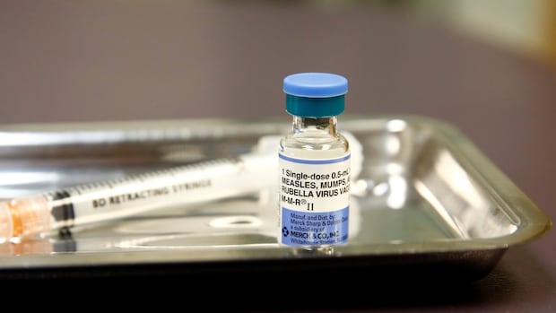 Measles spread trending down as Alberta kids head back to the classroom. Will it last?